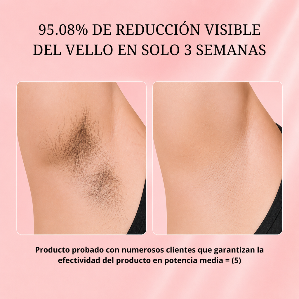 IPL Máquina de depilación refrigerada
